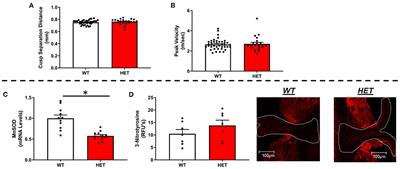 Effects of Altering Mitochondrial Antioxidant Capacity on Molecular and Phenotypic Drivers of Fibrocalcific Aortic Valve Stenosis